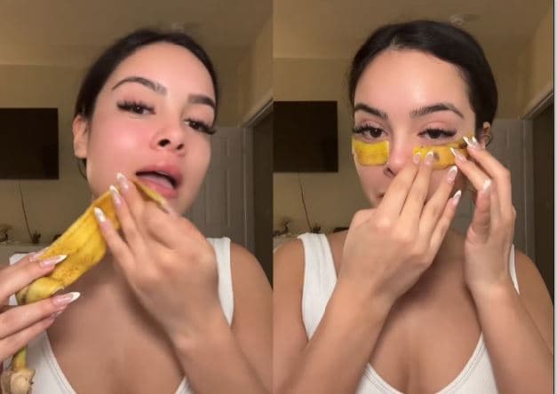 바나나 껍질 얼굴에 문지르면 ‘천연 보톡스’… 효과 있을까? 